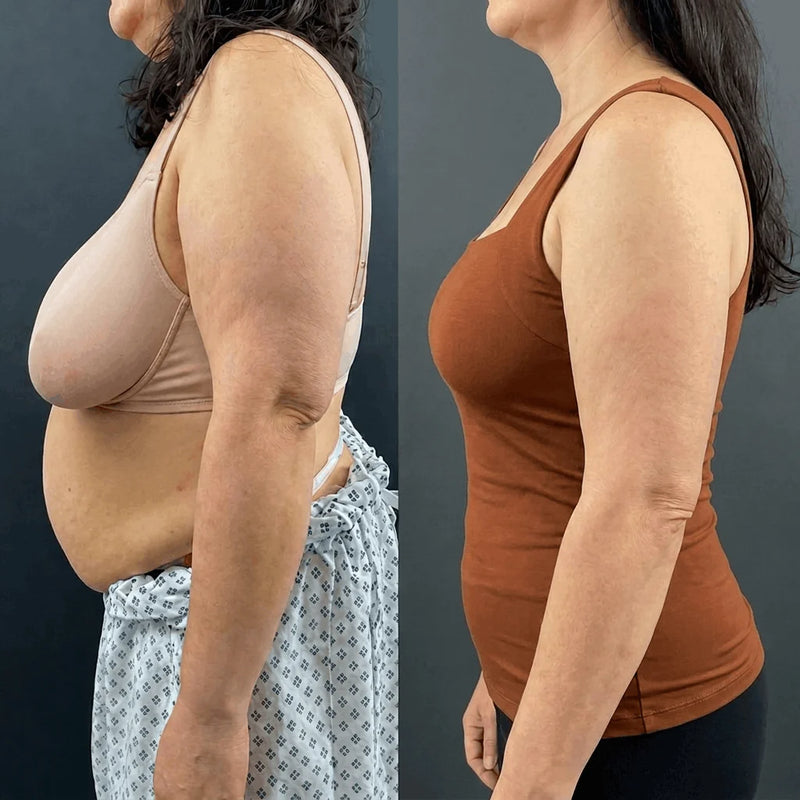 Patricia R. before and after